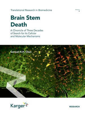 cover image of Brain Stem Death